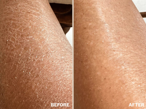 Retreatment Botanics The Body Renewal Set Obnovující tělový set 6