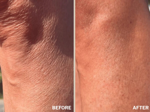 Retreatment Botanics The Body Renewal Set Obnovující tělový set 7